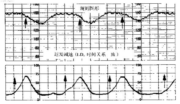 三,变异减速